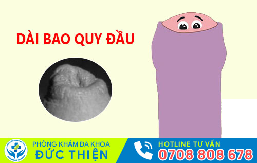 Hình ảnh bao quy đầu dài
