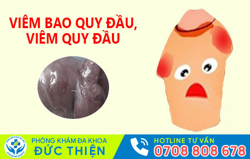 Biểu hiện viêm bao quy đầu ở nam giới