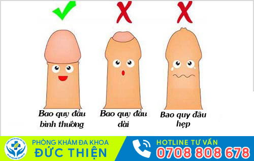 Hình ảnh bao quy đầu bất thường