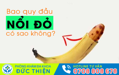Bao quy đầu nổi đỏ, nổi hạt do nhiều nguyên nhân gây nên