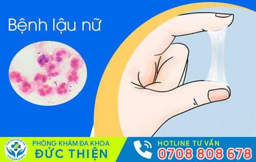 Bệnh lậu khiến chị em đi tiểu ra máu, huyết trắng có mùi khó chịu