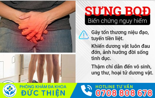 Sưng tấy ở quy đầu dẫn đến nhiều biến chứng nguy hiểm
