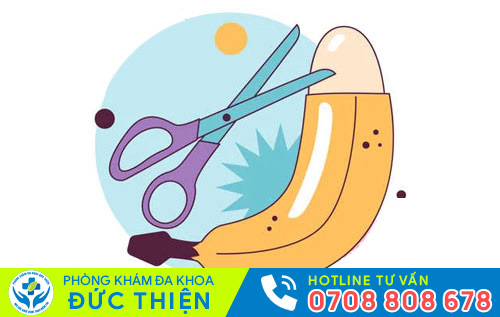 Cắt bao quy đầu bao nhiêu tiền phụ thuộc vào nhiều yếu tố