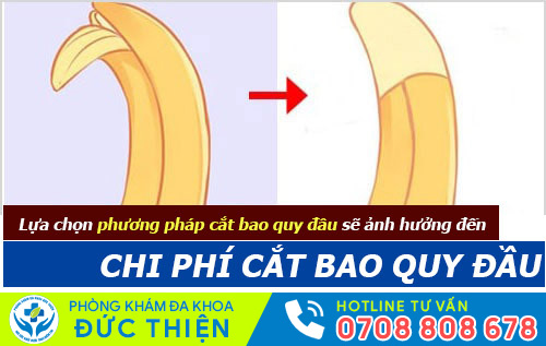 Chi phí cắt bao quy đầu phụ thuộc một phần vào phương pháp