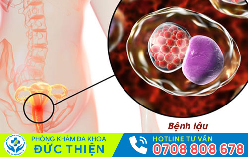 Nguyên nhân đi giải ra máu