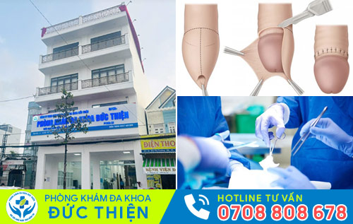 Địa chỉ cắt bao quy đầu uy tín tại Cà Mau