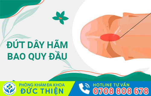 Đứt dây hãm bao quy đầu