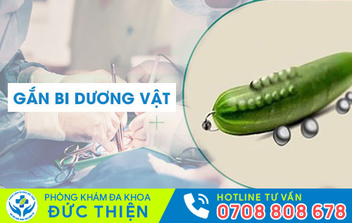 Gắn bi dương vật