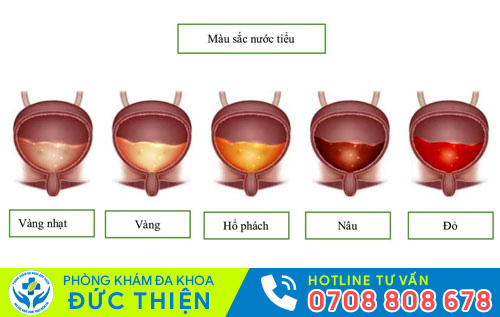 Màu sắc nước tiểu