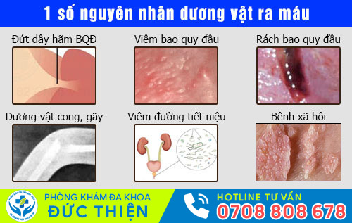 Dương vật ra máu do nhiều bệnh lý nguy hiểm