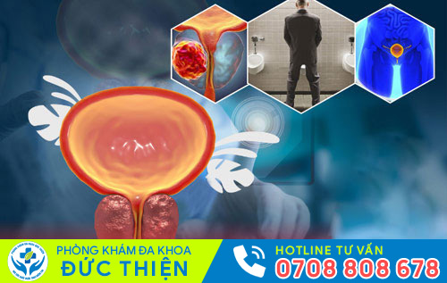 Nguy hại của phì đại tuyến tiền liệt