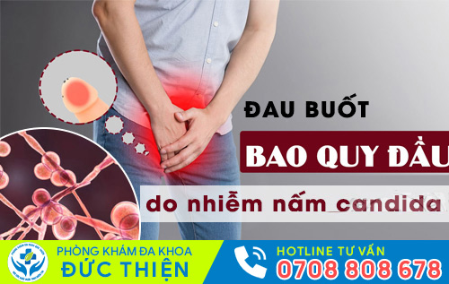 Đau buốt quy đầu do nhiễm nấm candida