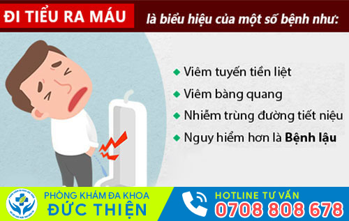 Tiểu có lẫn máu là dấu hiệu nhiều bệnh nguy hiểm