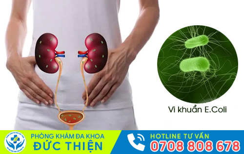 Viêm đường tiết niệu nam do vi khuẩn E.coli gây nên