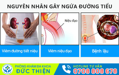 Ngứa đường tiểu là bệnh gì?