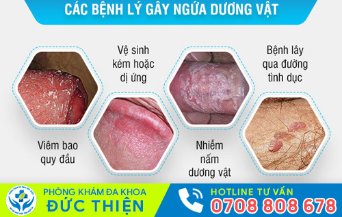 Ngứa bao quy đầu do nhiều nguyên nhân gây nên