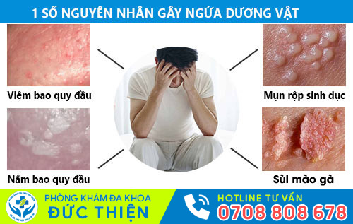 Ngứa dương vật là dấu hiệu nhiều bệnh nguy hiểm