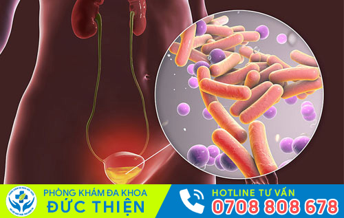 Nguyên nhân gây viêm đường tiểu ở nam giới
