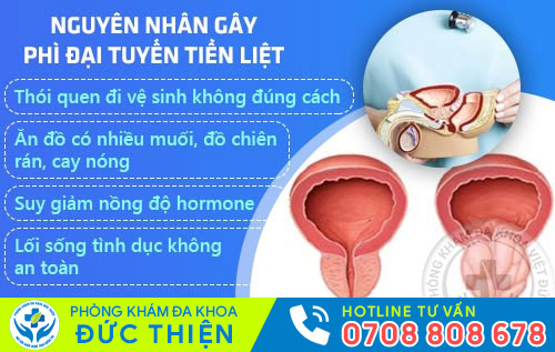 Nguyên nhân gây phì đại tuyến tiền liệt