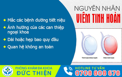 Nguyên nhân gây viêm tinh hoàn