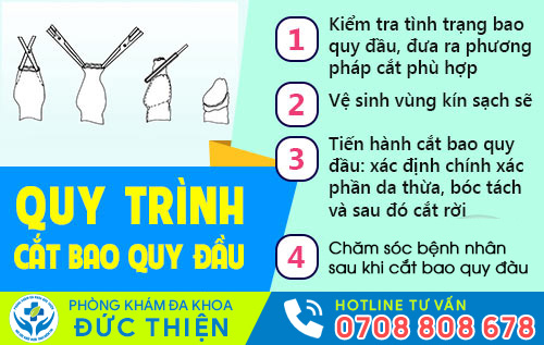 quy-trinh-cat-bao-quy-dau-1