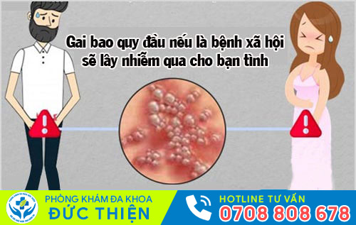 Tác hại của gai bao quy đầu