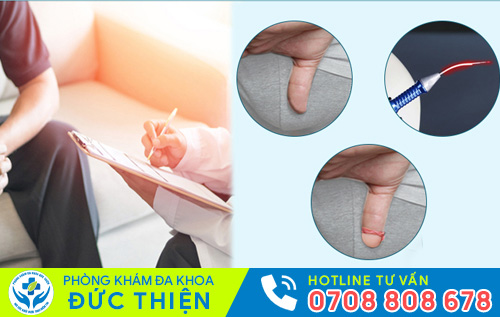 Tiểu phẫu cắt bao quy đầu giúp nam giới hết bị dài bao quy đầu