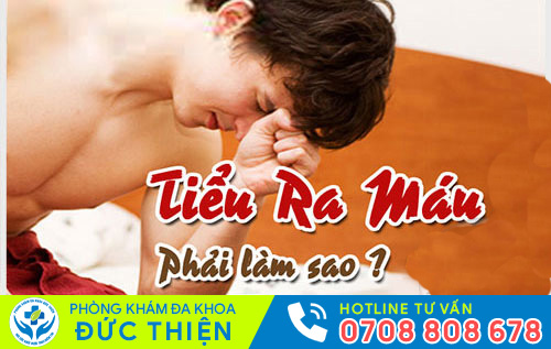 Điều trị tiểu ra máu như thế nào?
