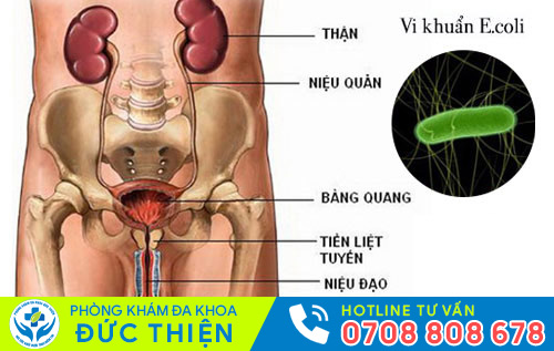 Các bệnh về đường tiết niệu, tuyến tiền liệt và niệu đạo có thể gây tiểu ra máu
