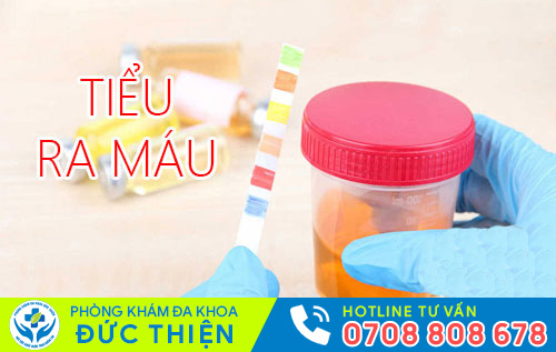 Tiểu ra máu khiến chị em thường xuyên bất an, lo lắng