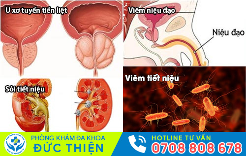 Các nguyên nhân dẫn đến tình trạng tiểu ra máu ở nam