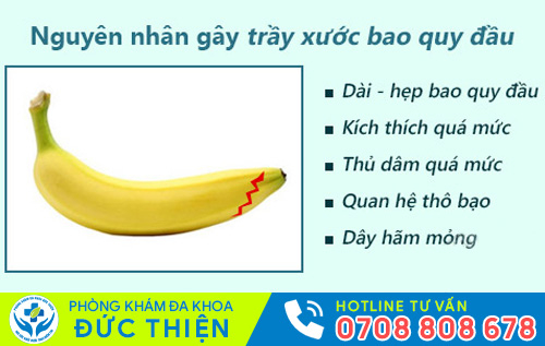 Trầy xước bao quy đầu do nhiều nguyên nhân gây nên