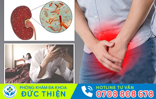 Tác hại không thể xem thường của viêm đường tiết niệu