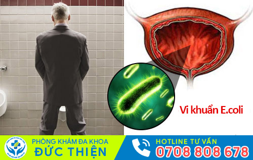 Viêm đường tiết niệu do vi khuẩn E.coli gây ra