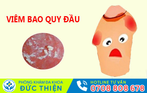 Viêm bao quy đầu làm xuất hiện các bợn trắng