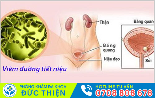 Viêm đường tiết niệu
