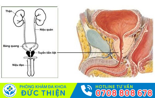 Viêm tuyến tiền liệt
