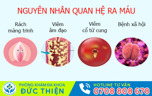 Nguyên nhân quan hệ ra máu