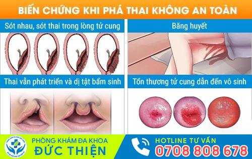 Uống thuốc phá thai không an toàn có thể gây nhiều biến chứng