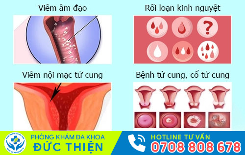 Biểu hiện của một số bệnh phụ khoa thường gặp