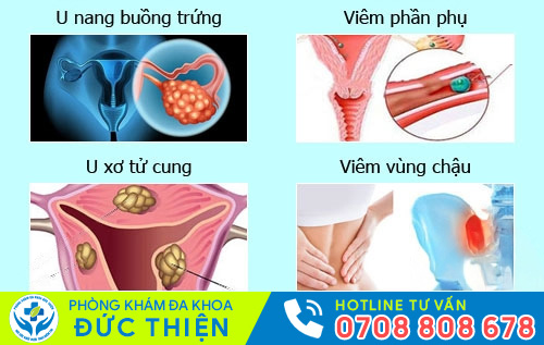 Biểu hiện viêm vùng chậu, viêm phần phụ, u xơ tử cung, u nang buồng trứng