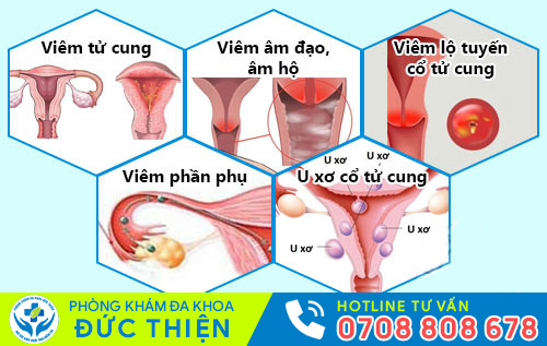 Các bệnh phụ khoa thường gặp