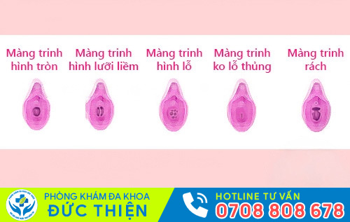 Các dạng màng trinh