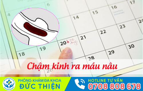 Châm kinh ra máu nâu