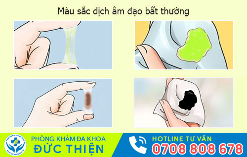 Dịch âm đạo