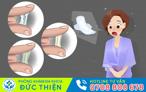 hiện tượng khí hư bất thường
