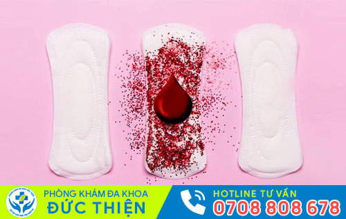 Hình ảnh máu kinh vón cục