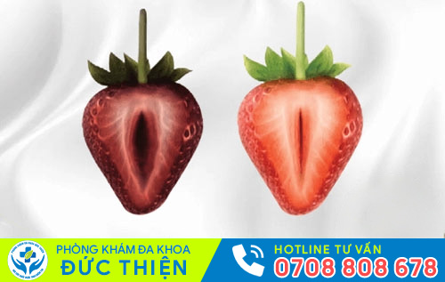 Kết quả sau khi thu hẹp âm đạo