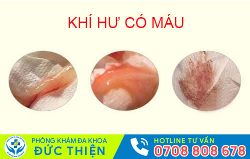 Khí hư có máu