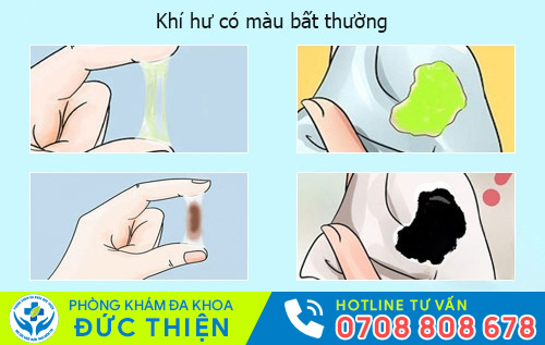Khí hư có màu - dấu hiệu cảnh báo một số bệnh phụ khoa